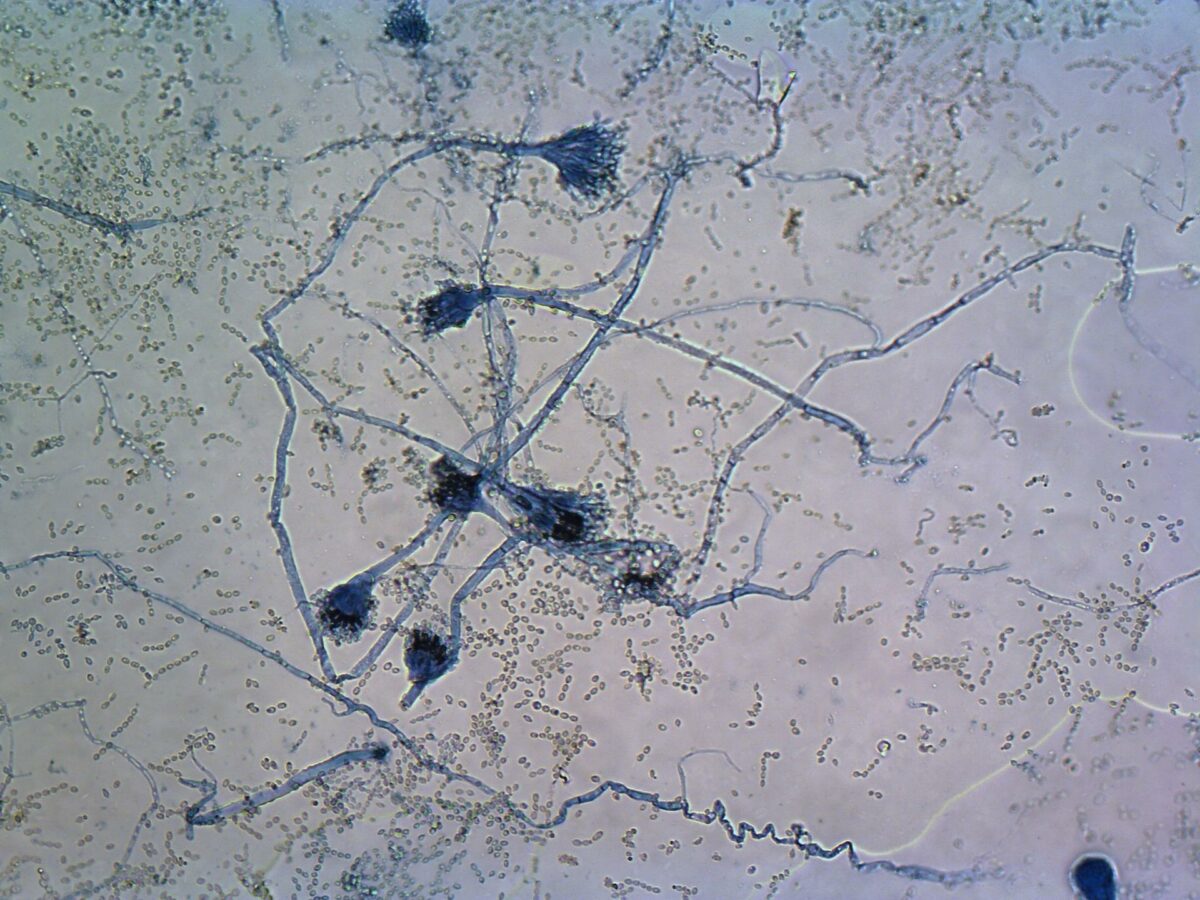 Smukt ser det ud, når man kommer helt tæt på. På billedet ses svampen Aspergillus, der på dansk kaldes Vandkandeskimmel. Det er svampe som denne, eksperterne arbejder på skal identificeres via kunstig intelligens. Foto: Teknologisk Institut.